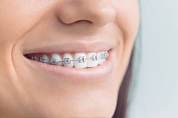 Best Traditional Braces  in Willoughby, OH